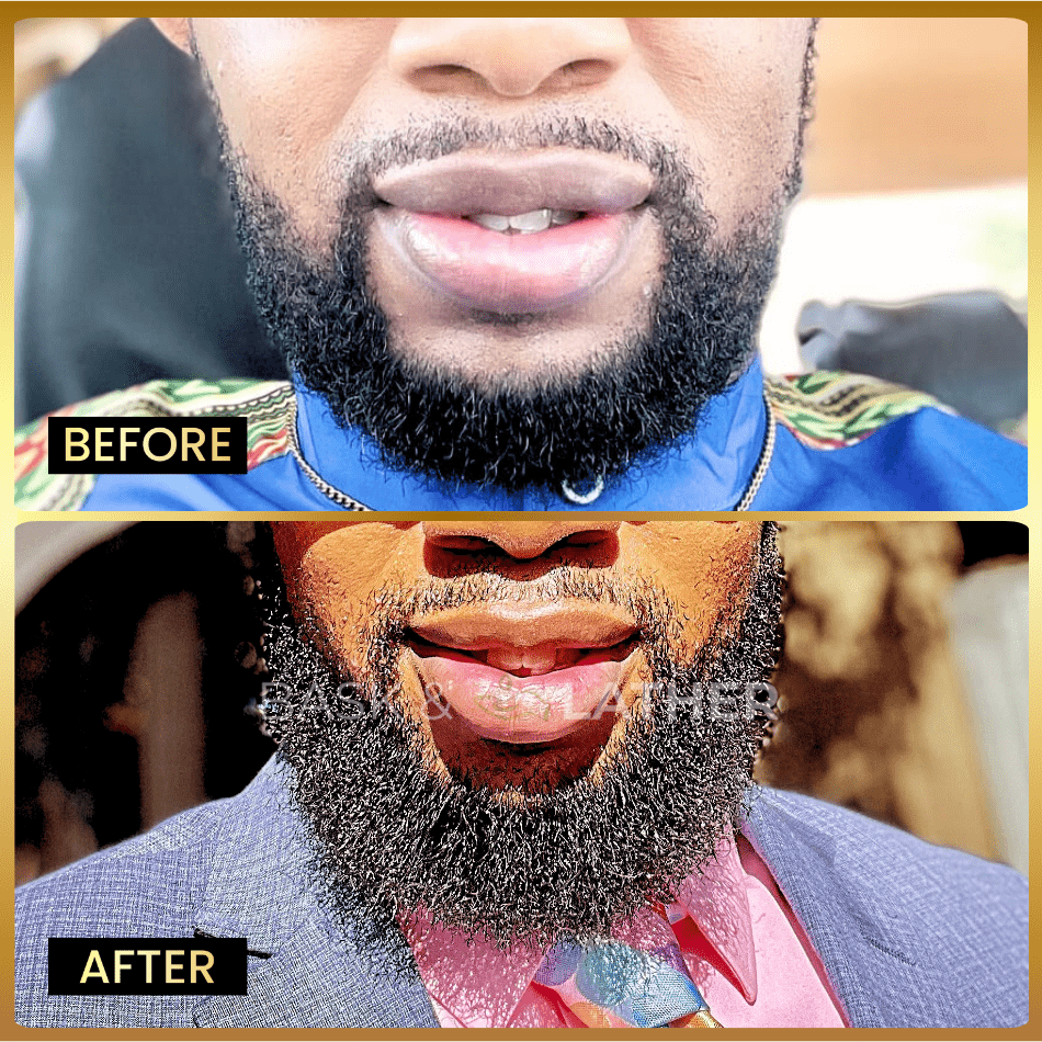 Beard Oil - Beard Softener & Growth Enhancer
