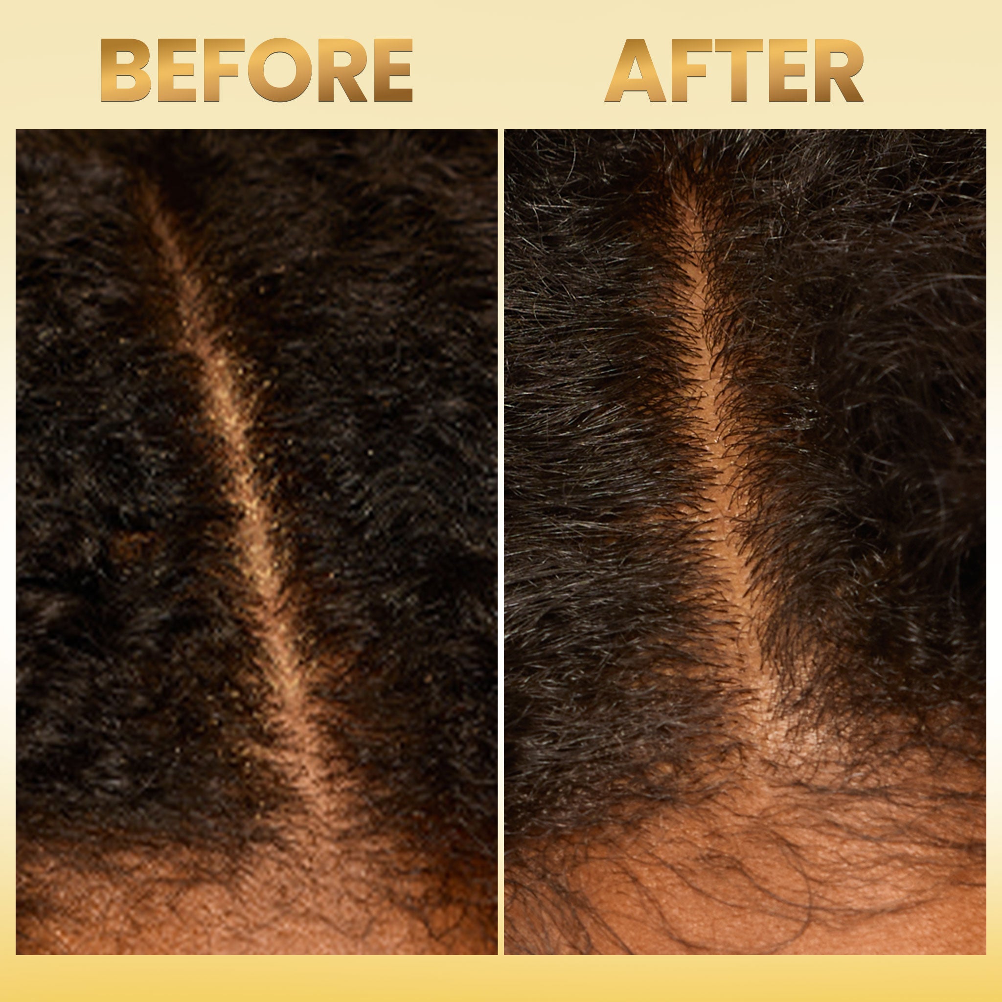 Scalp Moisturizing Leave-In Treatment